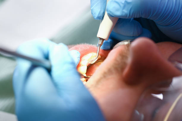 Best Cracked Tooth Emergency Dentist  in Lake Ketchum, WA