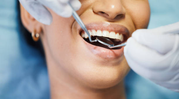 Best Urgent Dental Care  in Lake Ketchum, WA